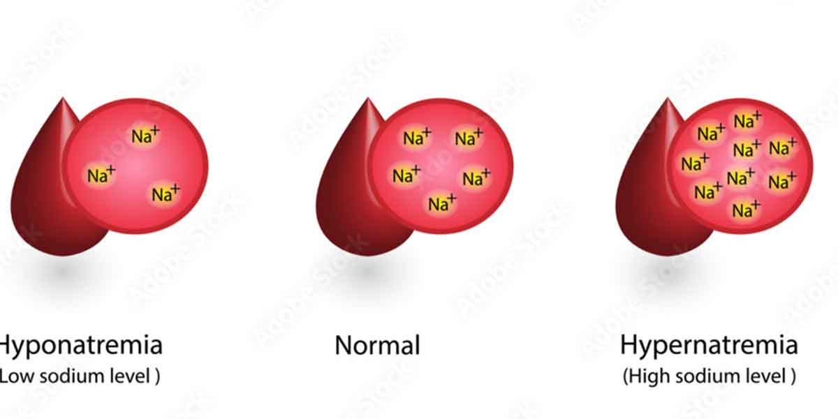 sodium1